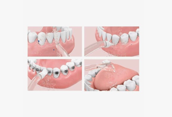 Ирригатор Xiaomi Soocas W3 Pro (Белый)